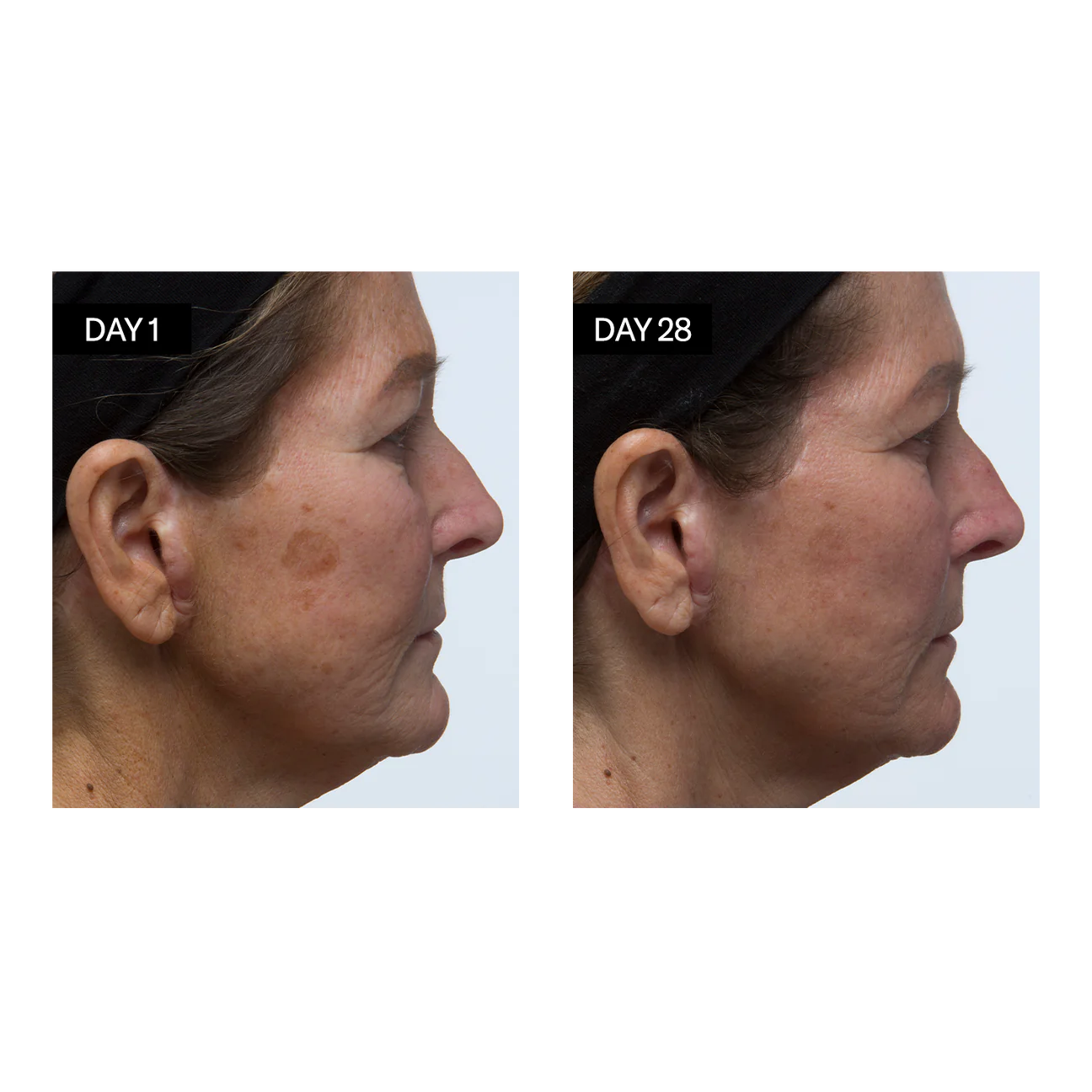 Odacité Šviesinantis Serumas (Vitaminas C ir E + Hialurono Rūgštis) 30ml