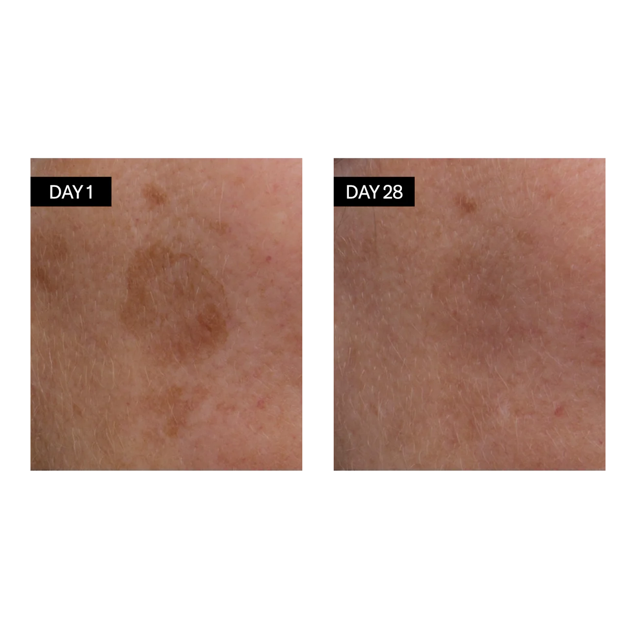 Odacité Šviesinantis Serumas (Vitaminas C ir E + Hialurono Rūgštis) 30ml