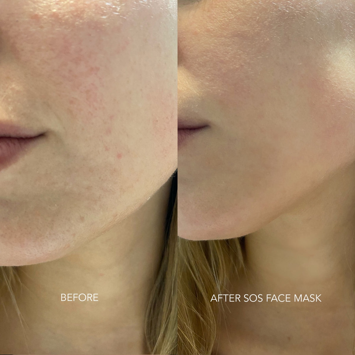 Masque visage SOS 50ml