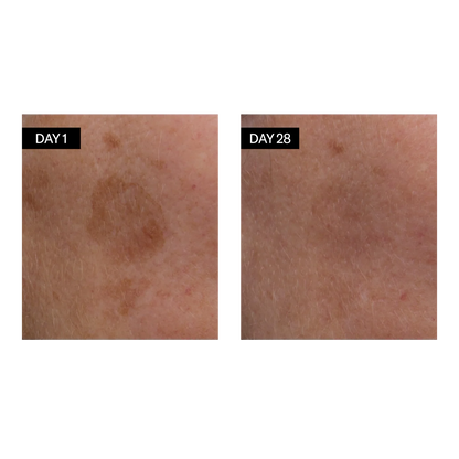 Odacité Šviesinantis Serumas (Vitaminas C ir E + Hialurono Rūgštis) 30ml